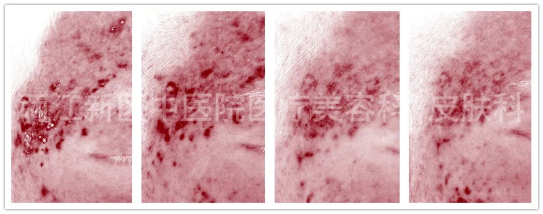 您想知道的“刷酸”知识都在这儿！