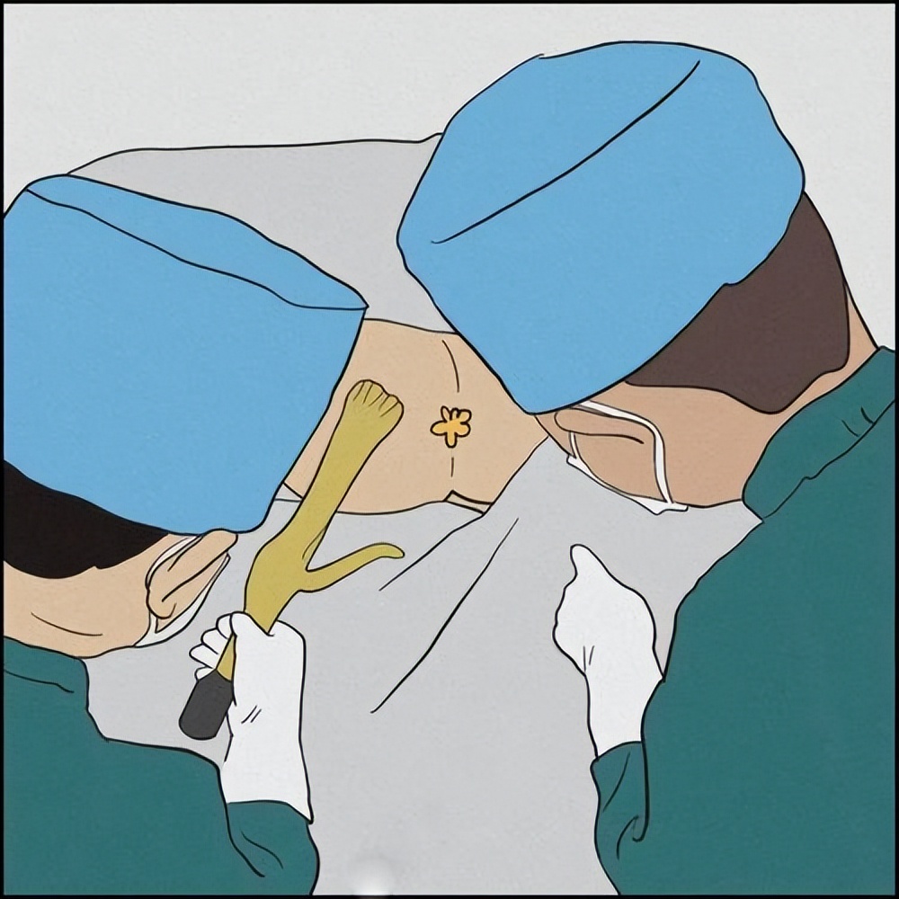 消痔灵内痔注射术操作视频,消痔灵四步注射法视频