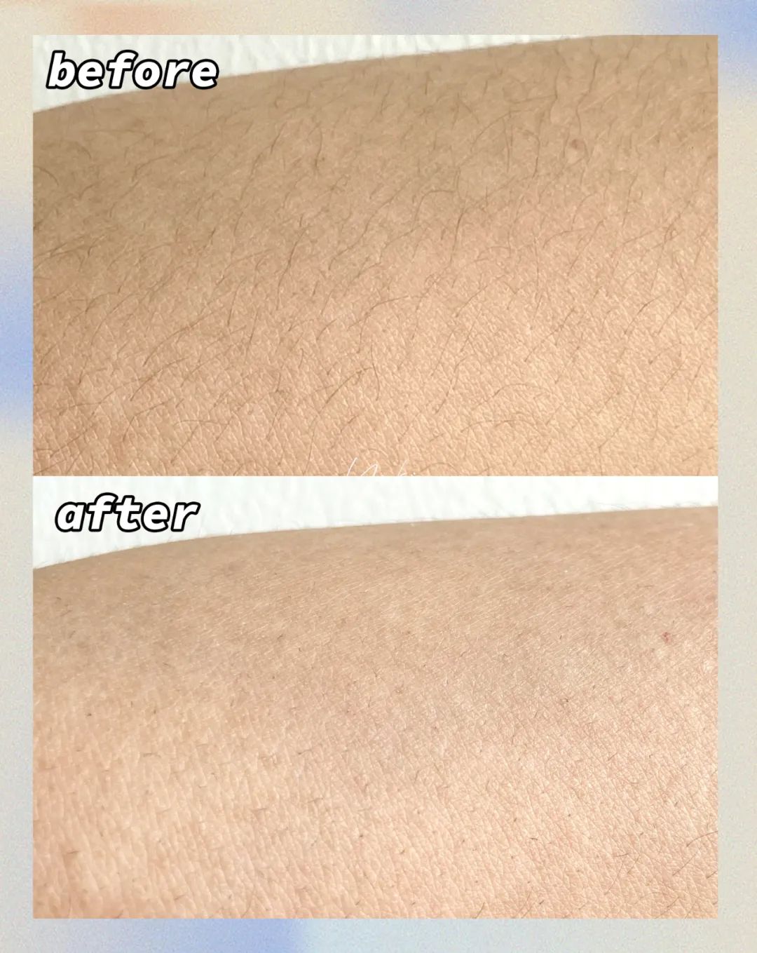 5款爆火脱毛产品真人实测!最便宜的居然是最好用?