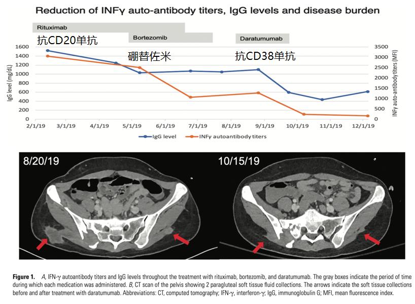 免疫缺陷病会并发什么病,什么是免疫缺陷肺部感染