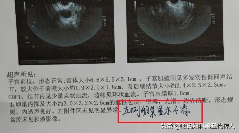 年纪轻轻卵巢早衰怎么补救,没到更年期但是卵巢早衰怎么调理