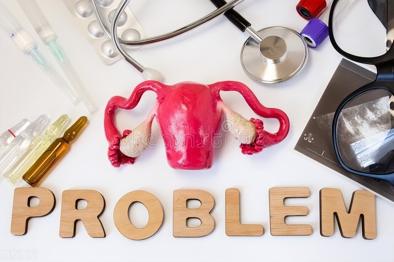 卵巢储备功能下降怎么治疗,卵巢储备功能减退共识