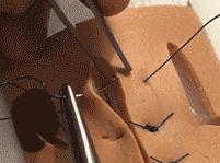 外科缝合技巧你熟练吗,外科缝合术的操作步骤