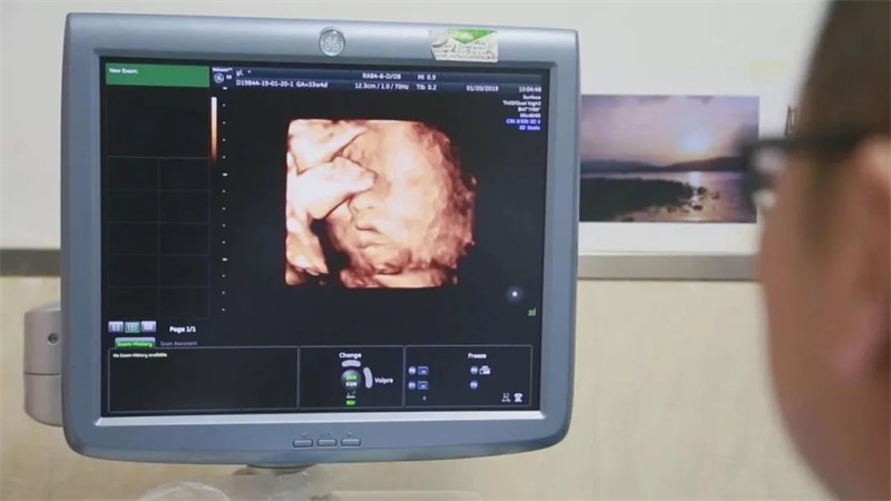 2015年43岁母亲将子宫移植给女儿,26岁女儿移植子宫生二胎