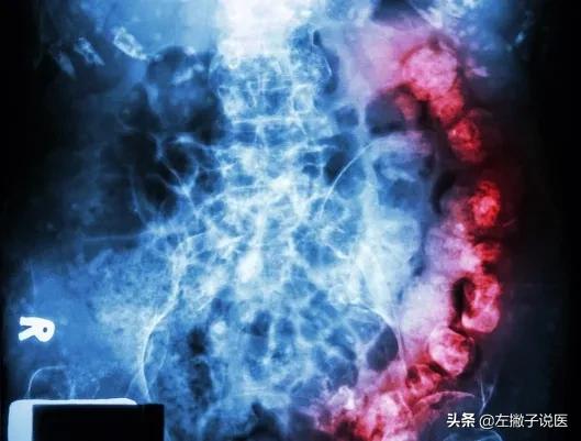 便秘不用吃药教你一个土方法,便秘最简单有效果的方法