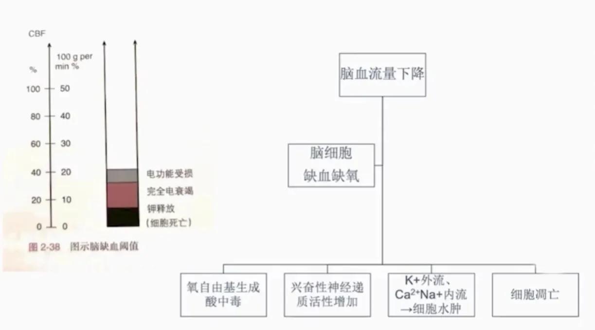 缺血性卒中治疗原则,缺血性卒中病因分型