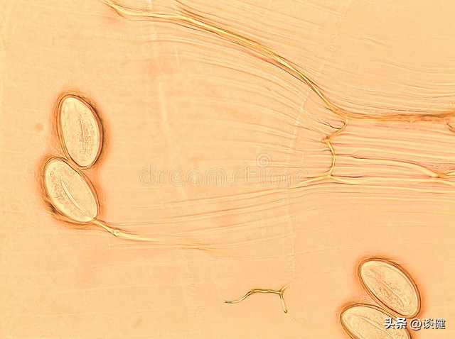阴道痒有分泌物是什么症状,阴道痒分泌物多什么症状