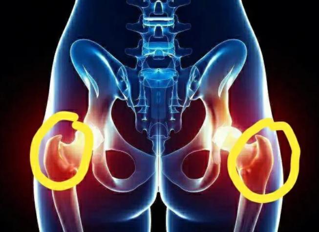 胯骨疼是什么原因造成的,胯骨疼是什么原因引起来的