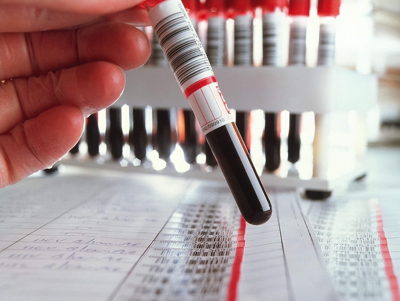 艾滋病引起的皮肤病一般持续多久,别把艾滋病当皮肤病治