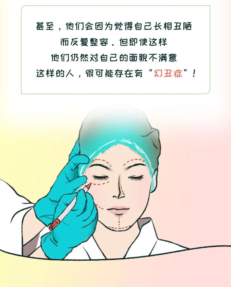 幻丑症解读视频,幻丑症