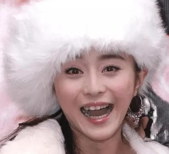 明明是绝顶大美女，却被牙齿拉胯，这15位女星苦不堪言