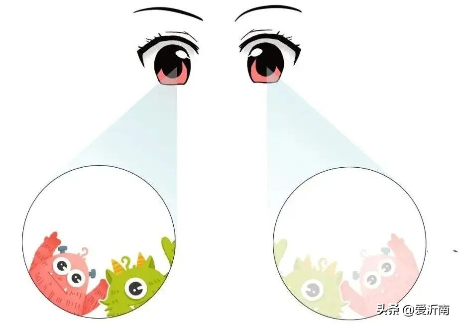 两只眼睛度数相差100度以上，这个问题不容忽视