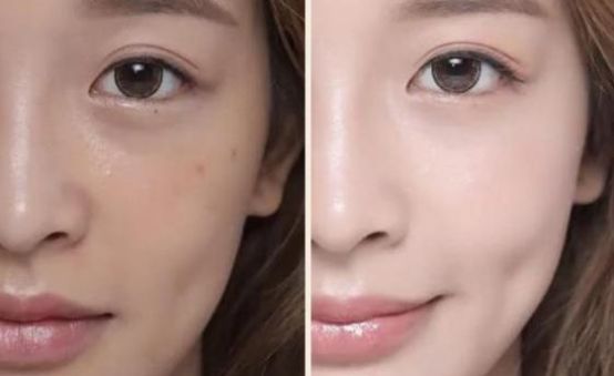 混合性肤质肤色偏黄该如何能改善,怎么可以改善皮肤粗糙暗黄肤质