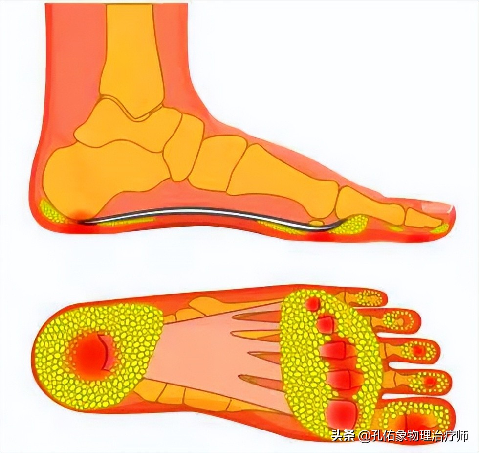 中老年人脚底痛是什么原因,老人脚底板好疼是什么原因