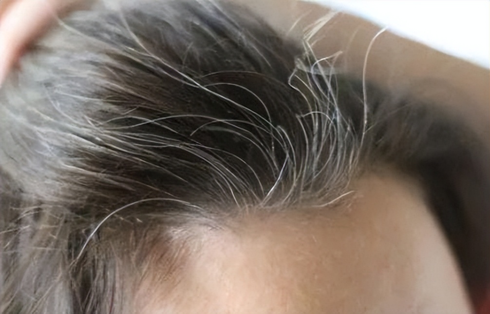 有白发不要急着染,有了白发的人要注意什么