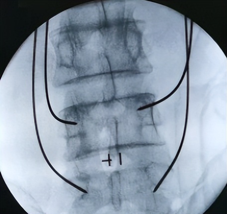 骨科看腰背痛做什么检查,腰背疼骨科检查没问题应该怎么办
