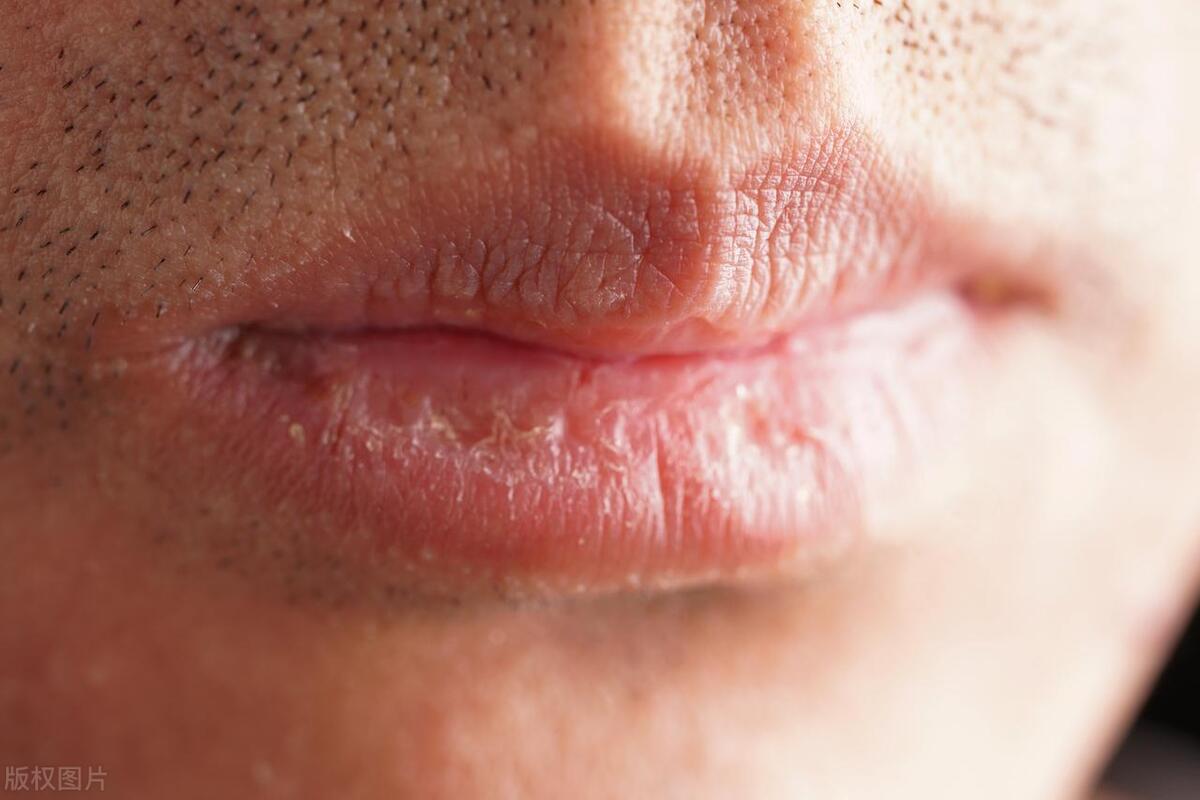 秋天一直喝水还是嘴唇干燥,秋天皮肤嘴唇干燥吃什么