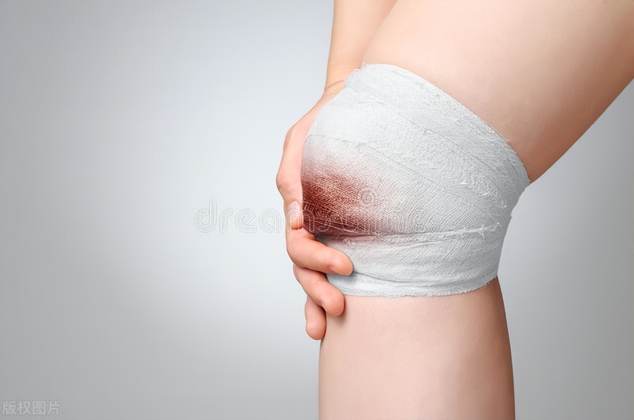 慢性伤口愈合成功案例,伤口为什么变得不容易愈合