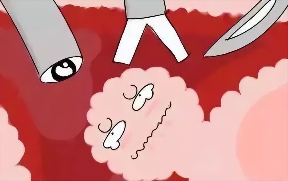 子宫肌瘤什么情况下要切除,子宫肌瘤可以反复切除吗