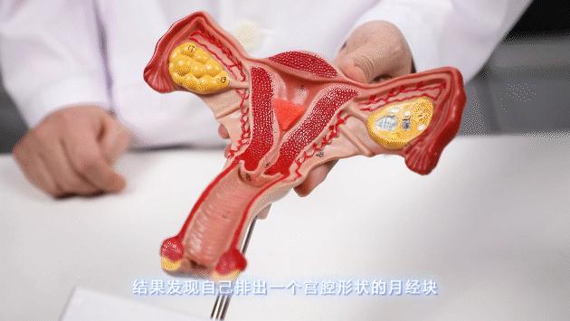 经血颜色辨别,经血到底什么颜色才算正常