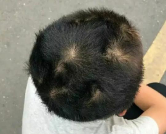 孩子头上的旋有什么含义,孩子头上的旋代表着什么