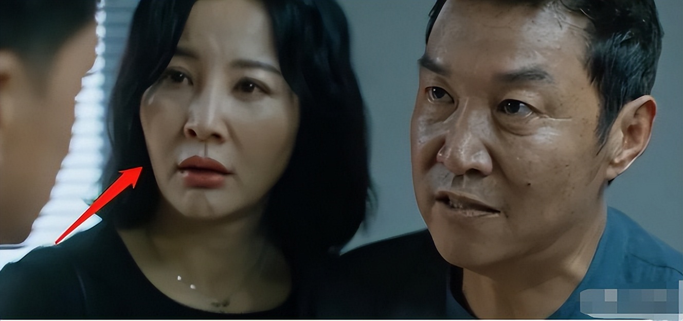 秦海璐澄清,秦海璐承认整容真的吗