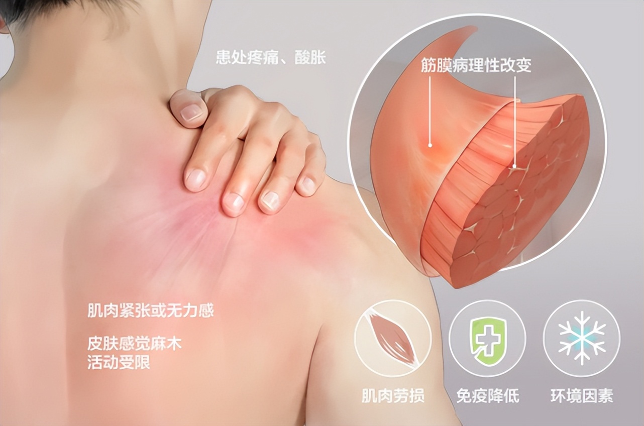 筋膜枪推荐送男友,筋膜枪礼物推荐