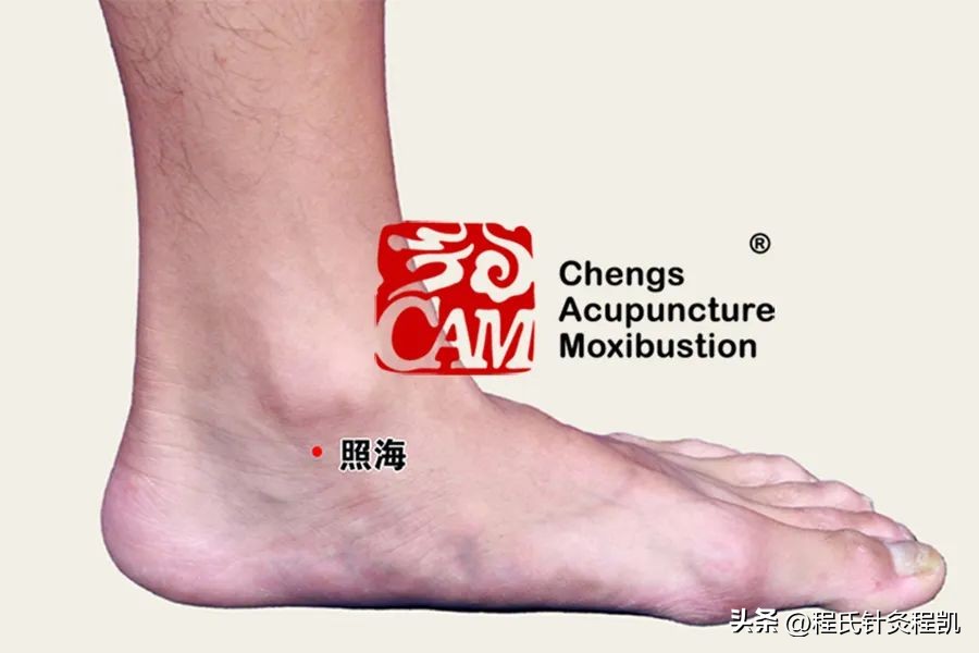 程凯养生说专栏荨麻疹,程凯养生说手麻原因