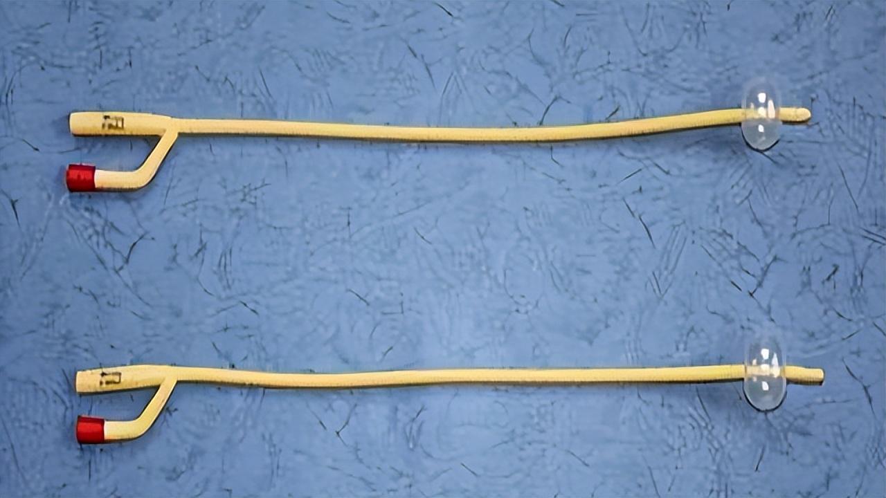 尿路感染多严重才可以感染到肾,切掉一个肾对泌尿系有影响么