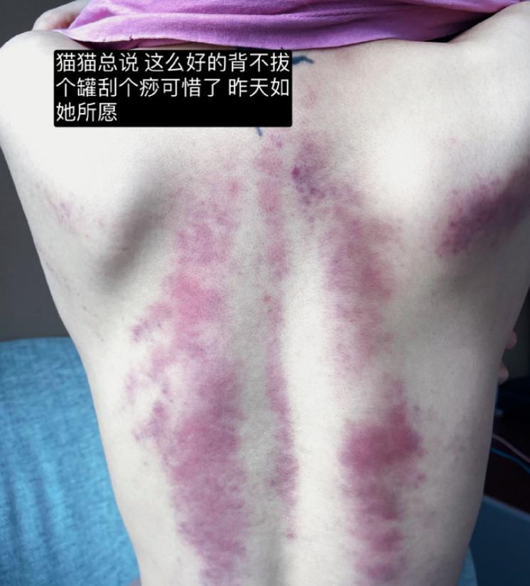 周扬青晒100斤身材,周扬青脸部消肿