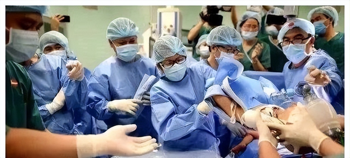 90后妈妈生三胞胎湖北武汉,生下连体婴的后果