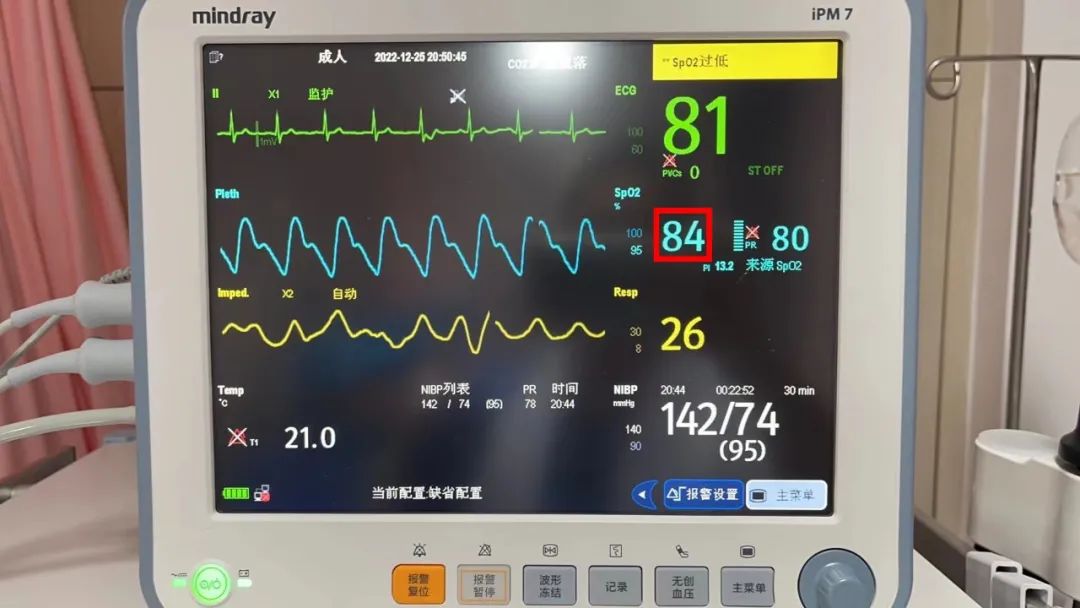 第一批阳性的孕妇生产,首阳孕妇咳嗽