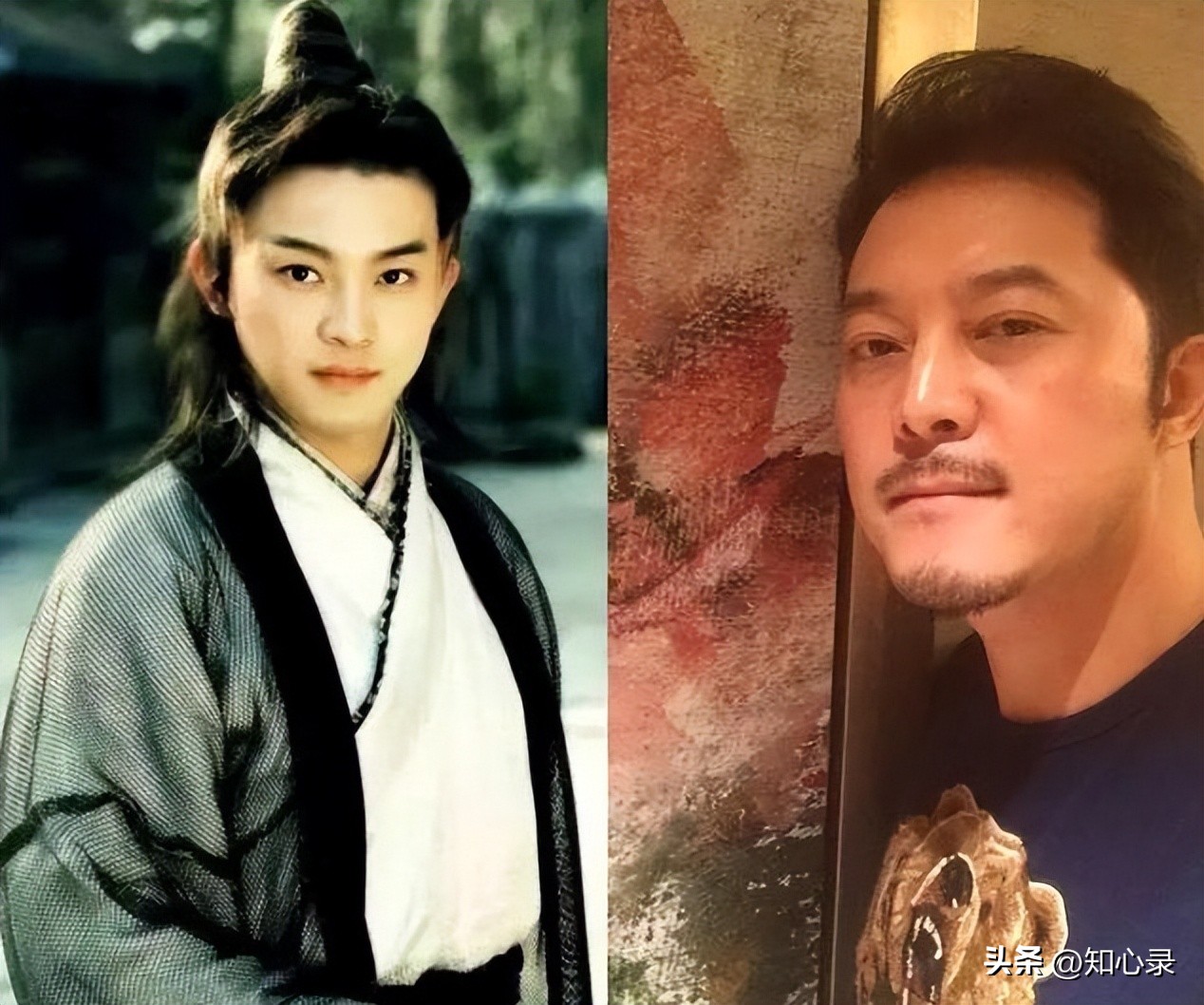 盘点9位明星毁容,盘点明星遭意外毁容