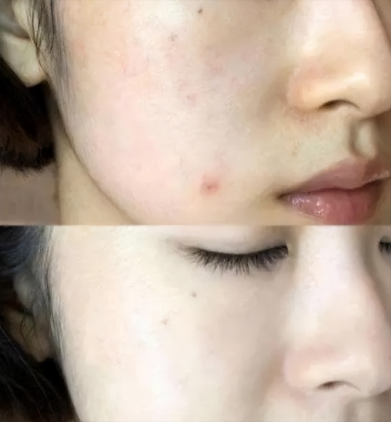 坚持使用精华液皮肤会变好吗,用了很多精华没效果反而皮肤更糟