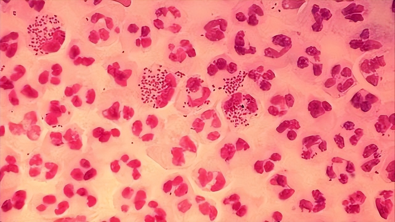 嘴巴周边起水泡是什么,嘴上上火长水泡传染吗