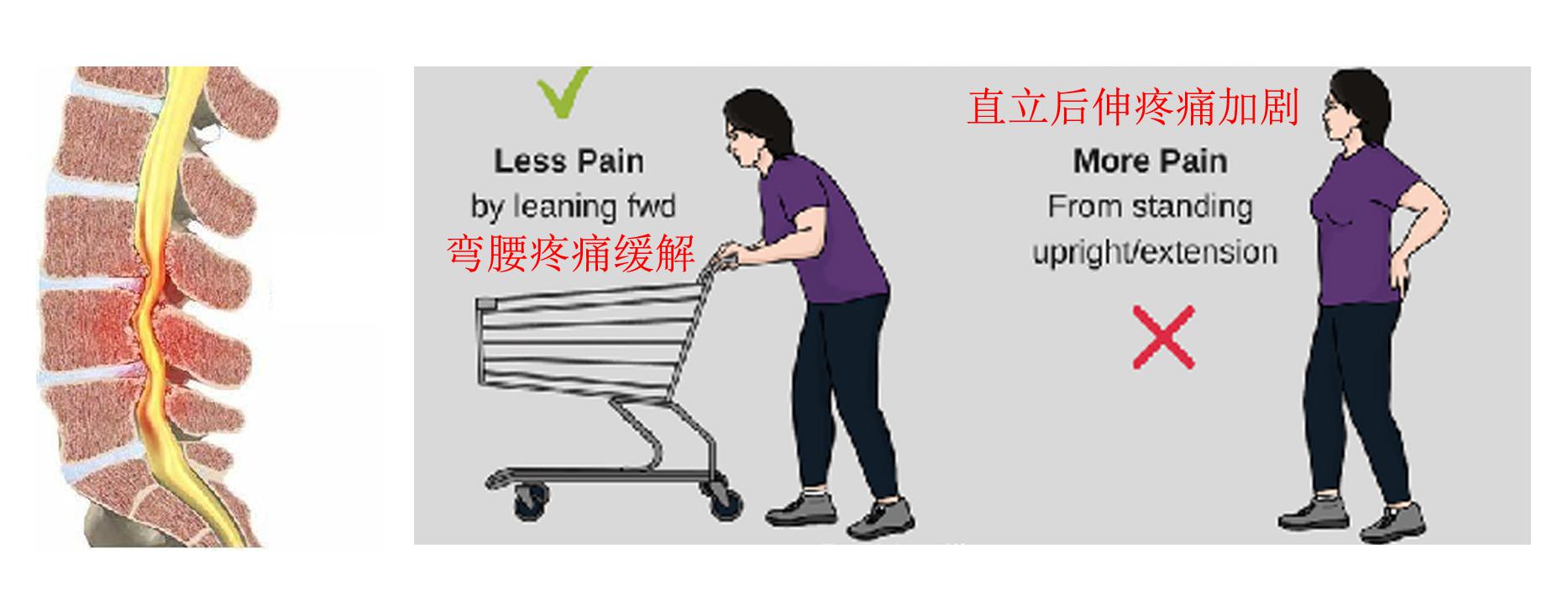 医学科普腰痛的原因 (健康医学科普知识腰痛)