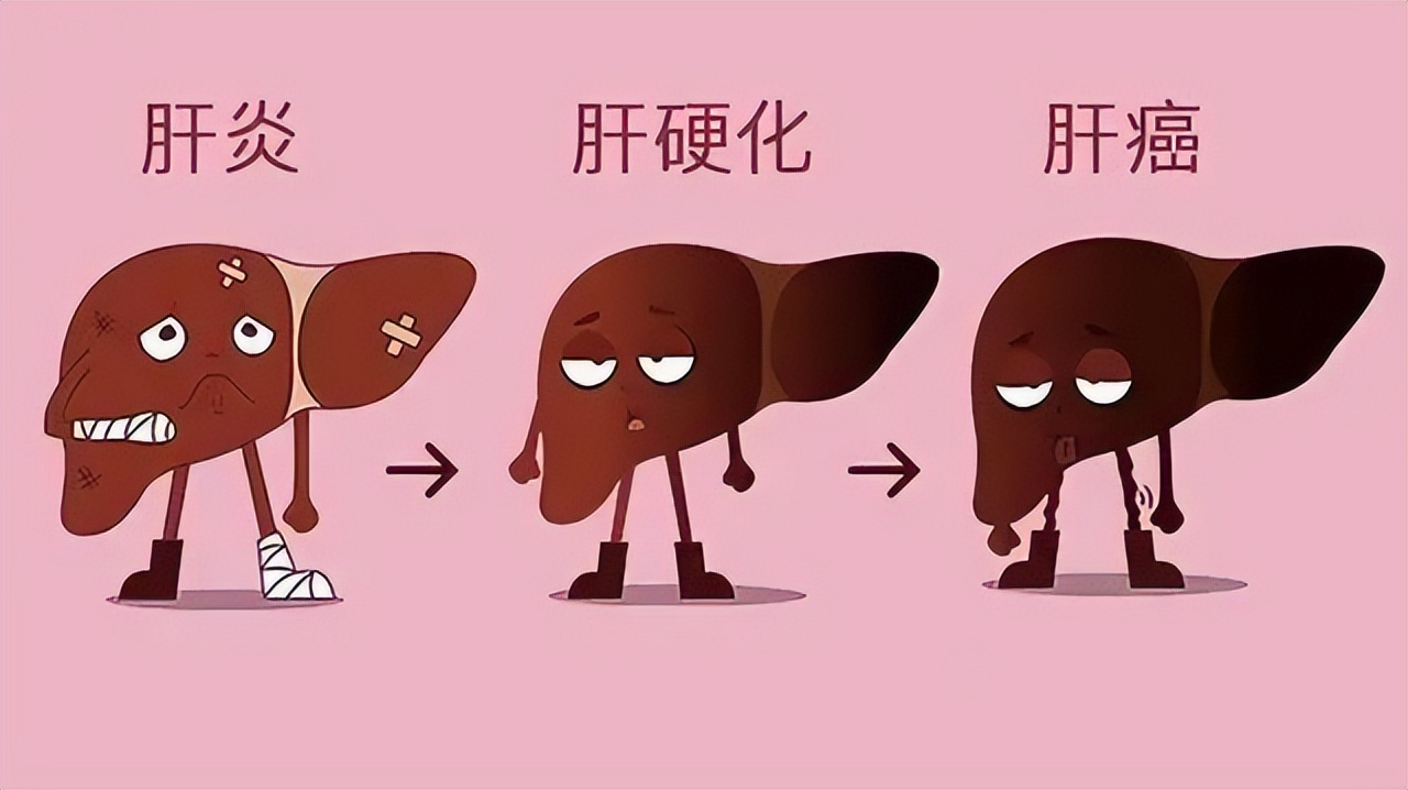 炎症到癌症一般多久,专家说长期炎症可能会拖成癌症