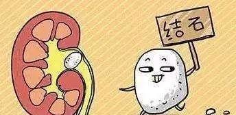 补钙会得结石吗怎么补钙最有效 (如何补钙不得钙结石)