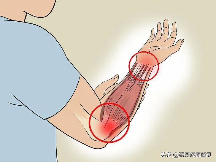 前臂疼痛，这五个动作就能缓解