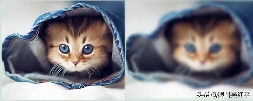 黄斑病变怎么预防,什么原因会导致黄斑病变