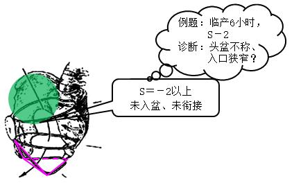 胎儿屁股在右侧是什么胎位,胎位roa屁股在左边还是右边