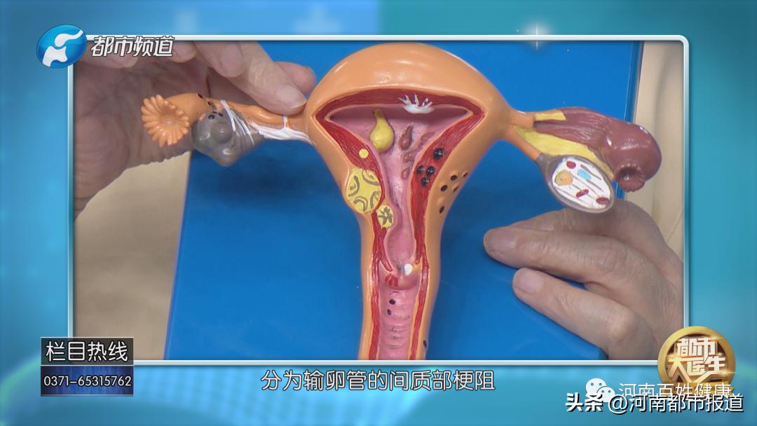 输卵管疾病能治好吗,输卵管有问题好不好治疗