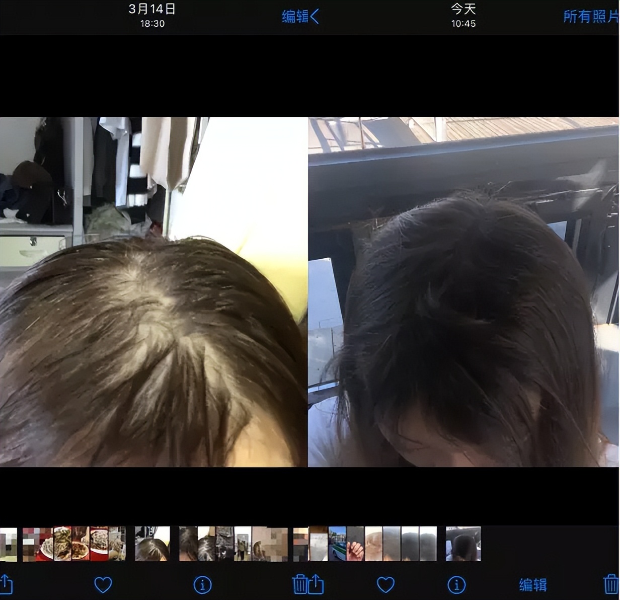 产后防脱发的洗发水有哪些,产后防脱发洗发水真实有效