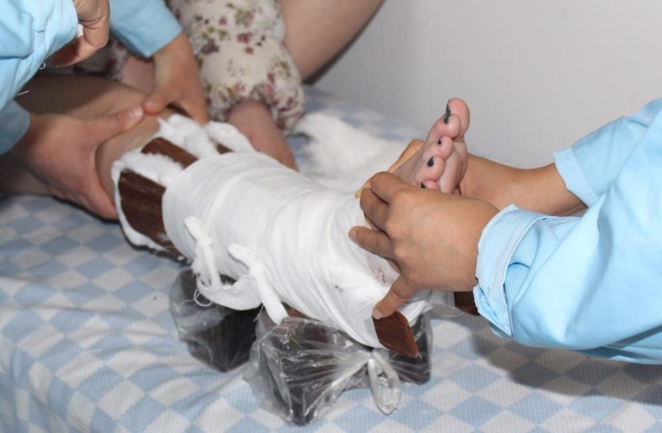 骨折后需要怎么治疗,骨折之后怎么办好得快