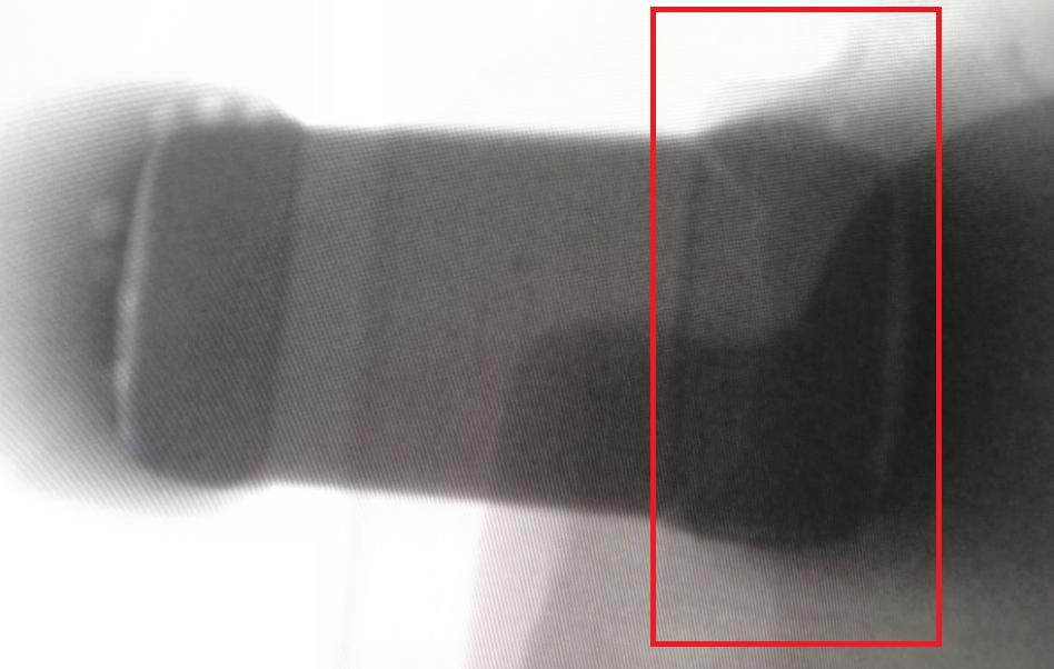 mlcc电容失效分析,mlcc贴片电容容量下降