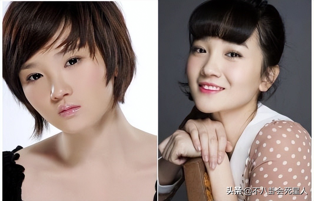 景甜双眼皮调整前后,明星自曝医美