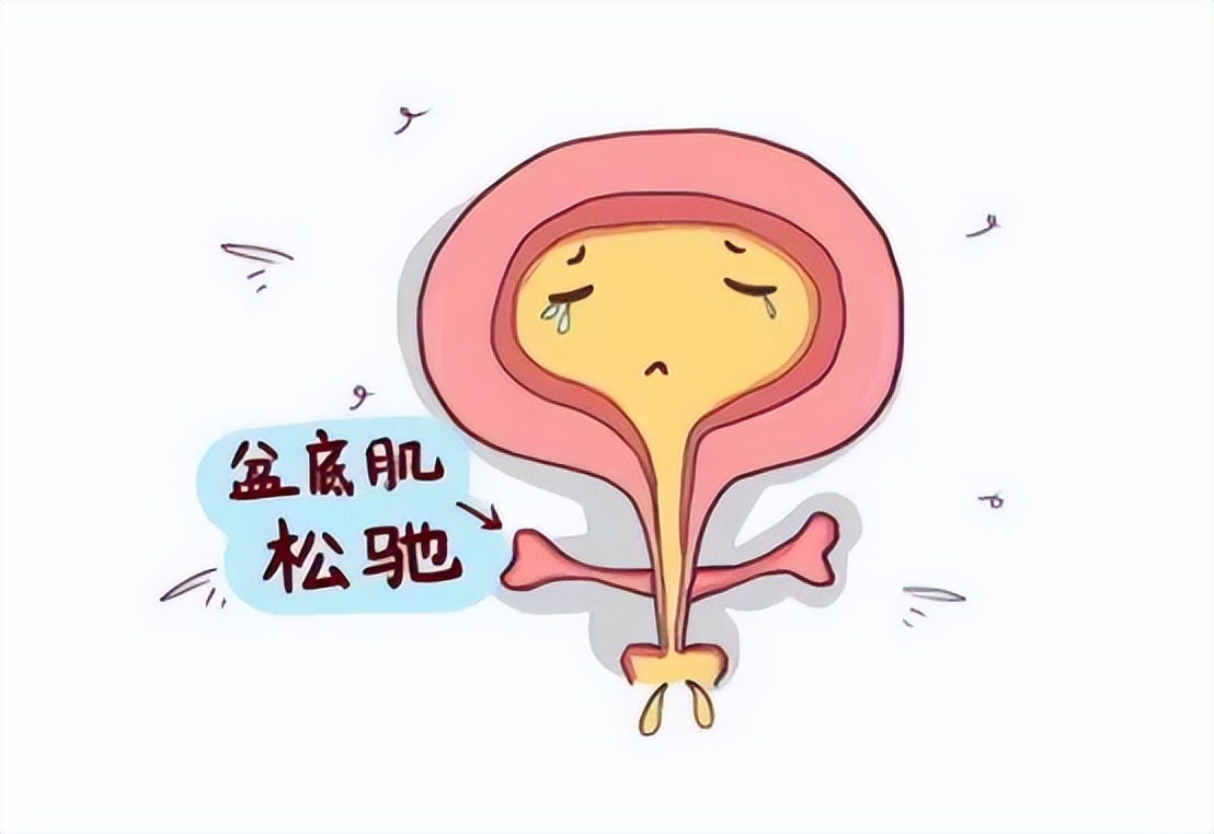拉拉裤漏尿怎么回事,一跳就漏尿怎么回事