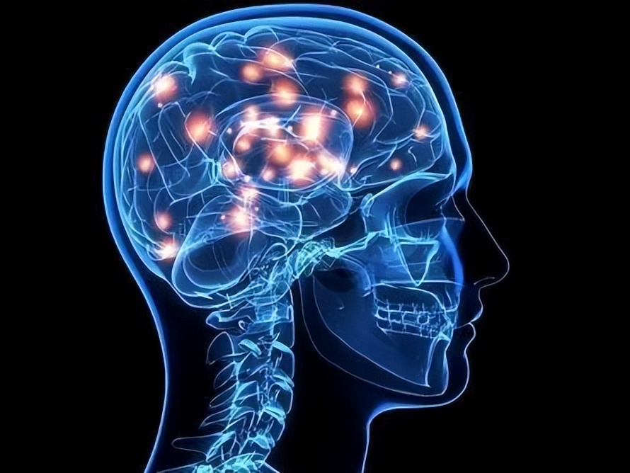 腔隙性脑梗死属于脑血栓么,腔隙性脑梗死属于心脑血管疾病吗