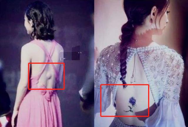 受疾病折磨的名人,受病痛折磨的五位明星