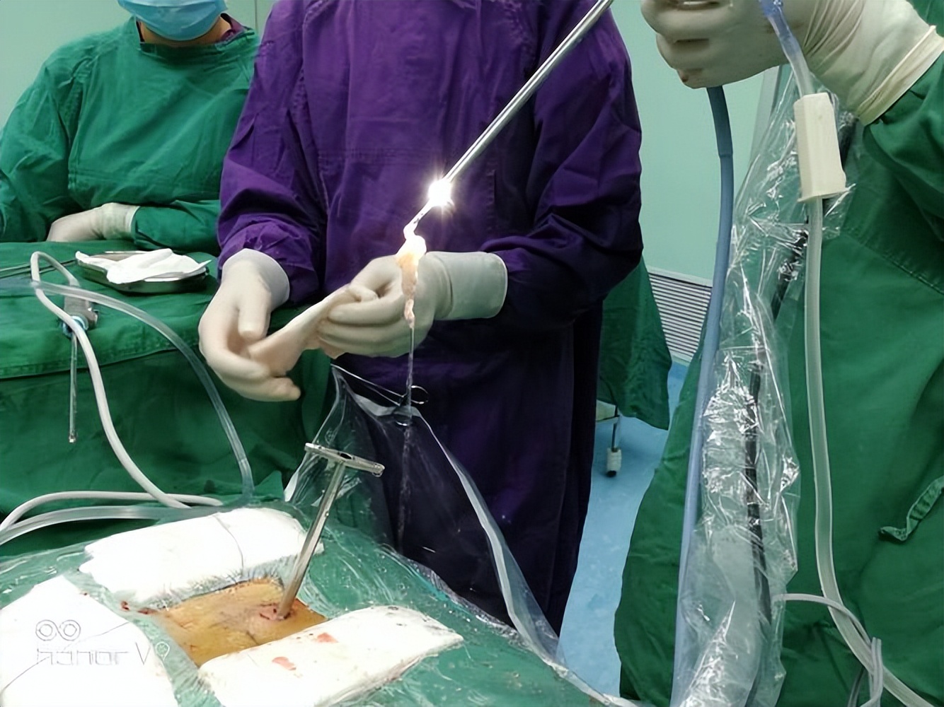 八十岁老人肝癌可以手术风险大吗,肝癌扩散怎么治疗治疗方案是什么